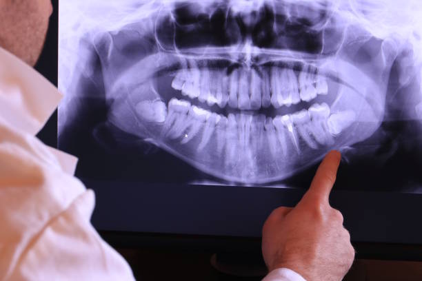 Best Mobile Emergency Dentist in Morristown, NJ